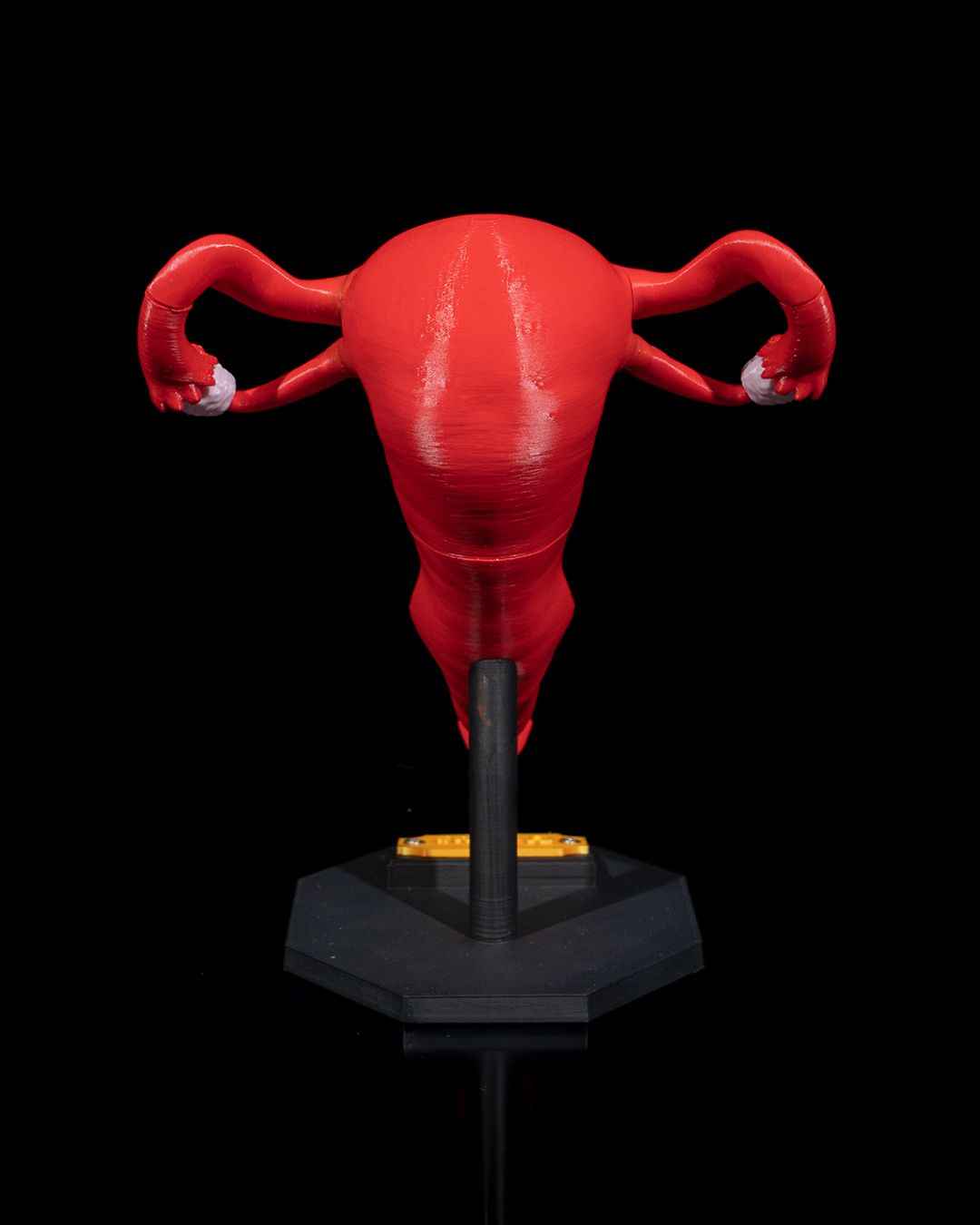 Uterus educational model