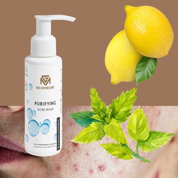 PURIFYNG ACNE WASH
