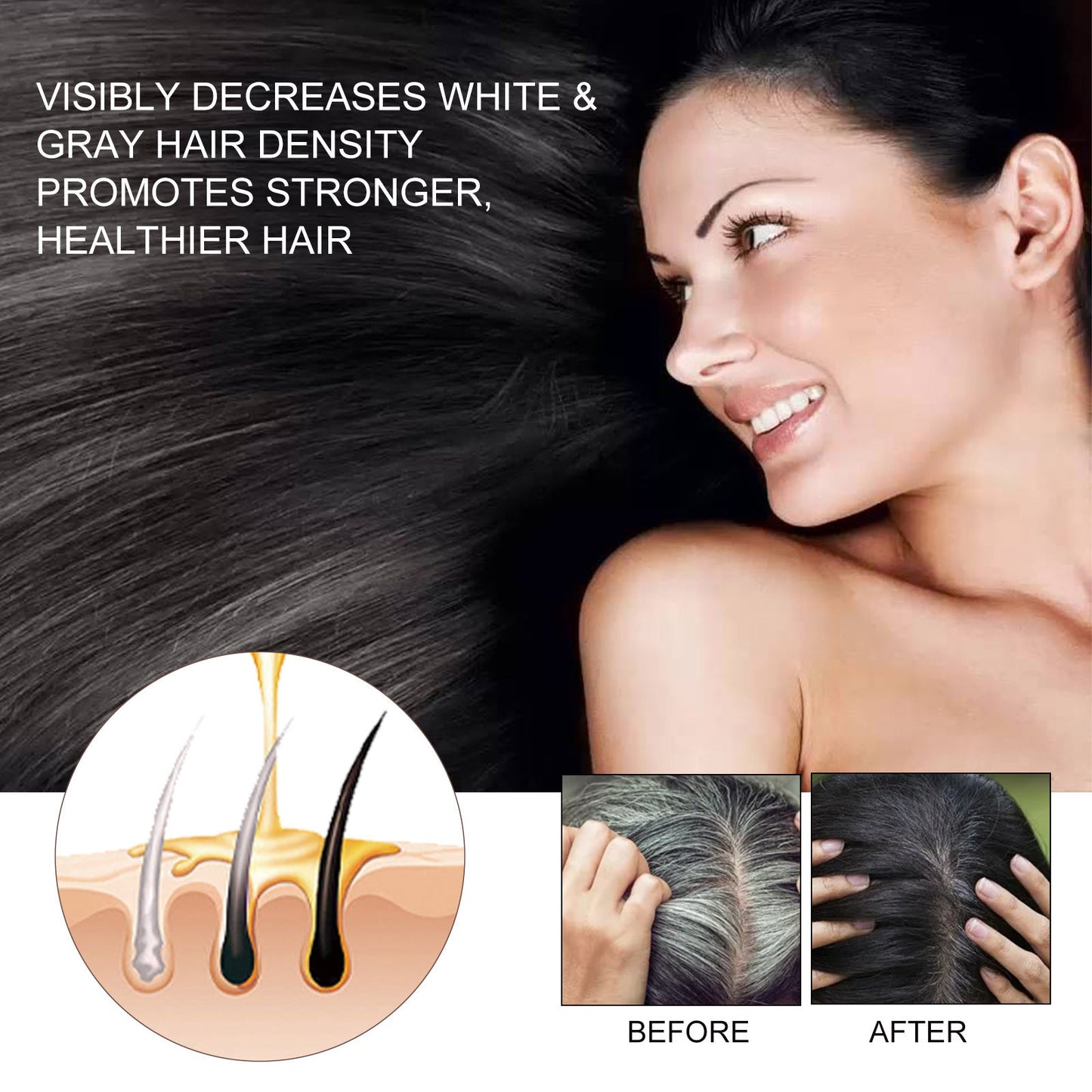 EELHOE Hair Growth Serum - Anti Hair Loss Treatment with Natural Botanicals | 30ml