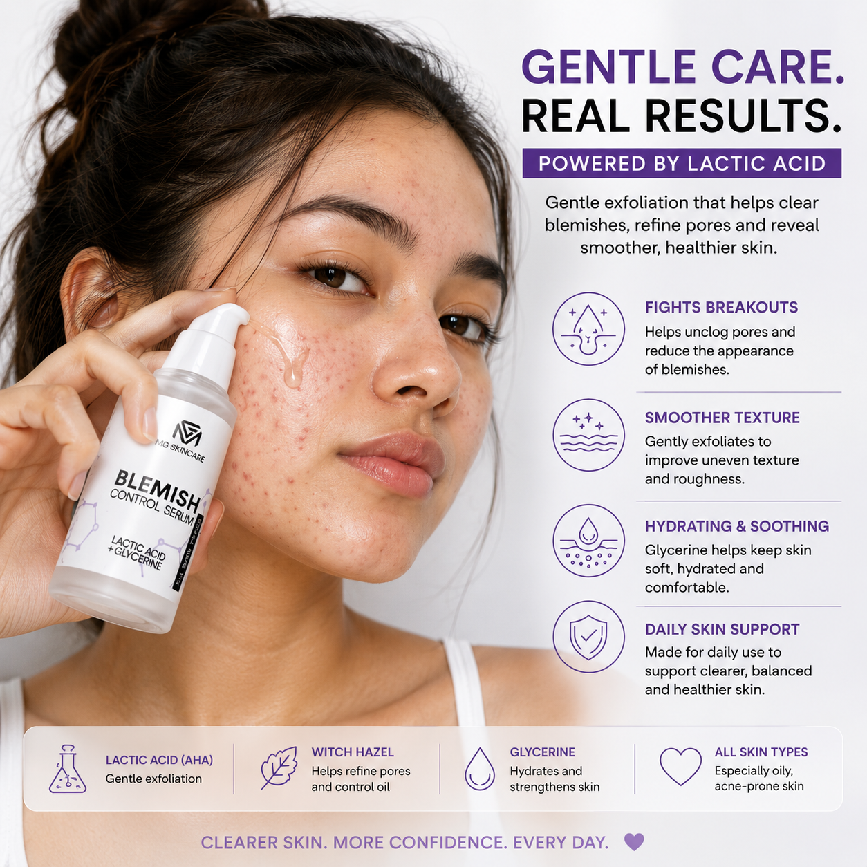 LACTIC ACID SERUM/BLEMISH CONTRO SERUM WITH LACTIC ACID.