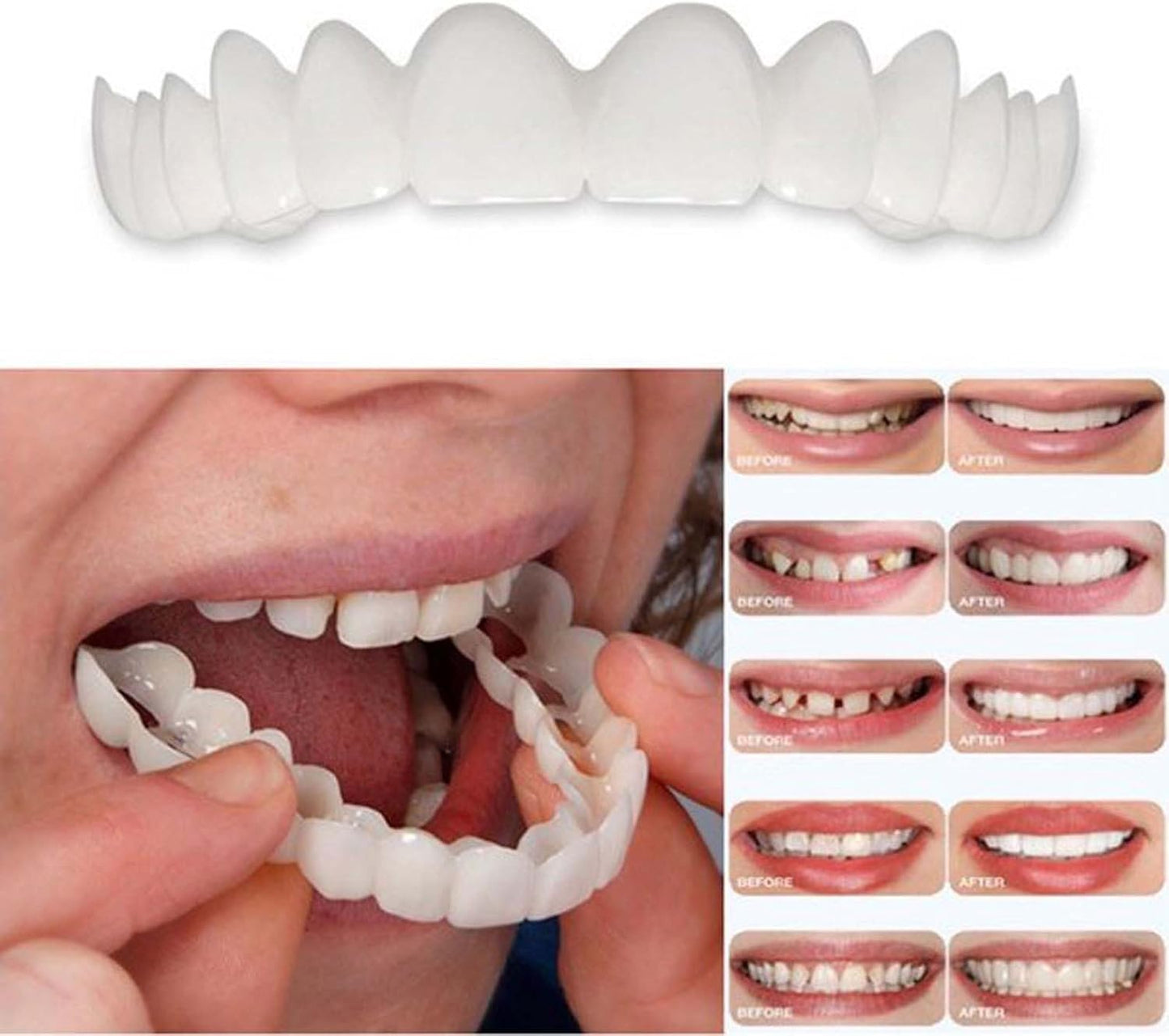 2 Pairs Temporarily Adjustable Smile Aligners – Natural & Comfortable for Men & Women (White)