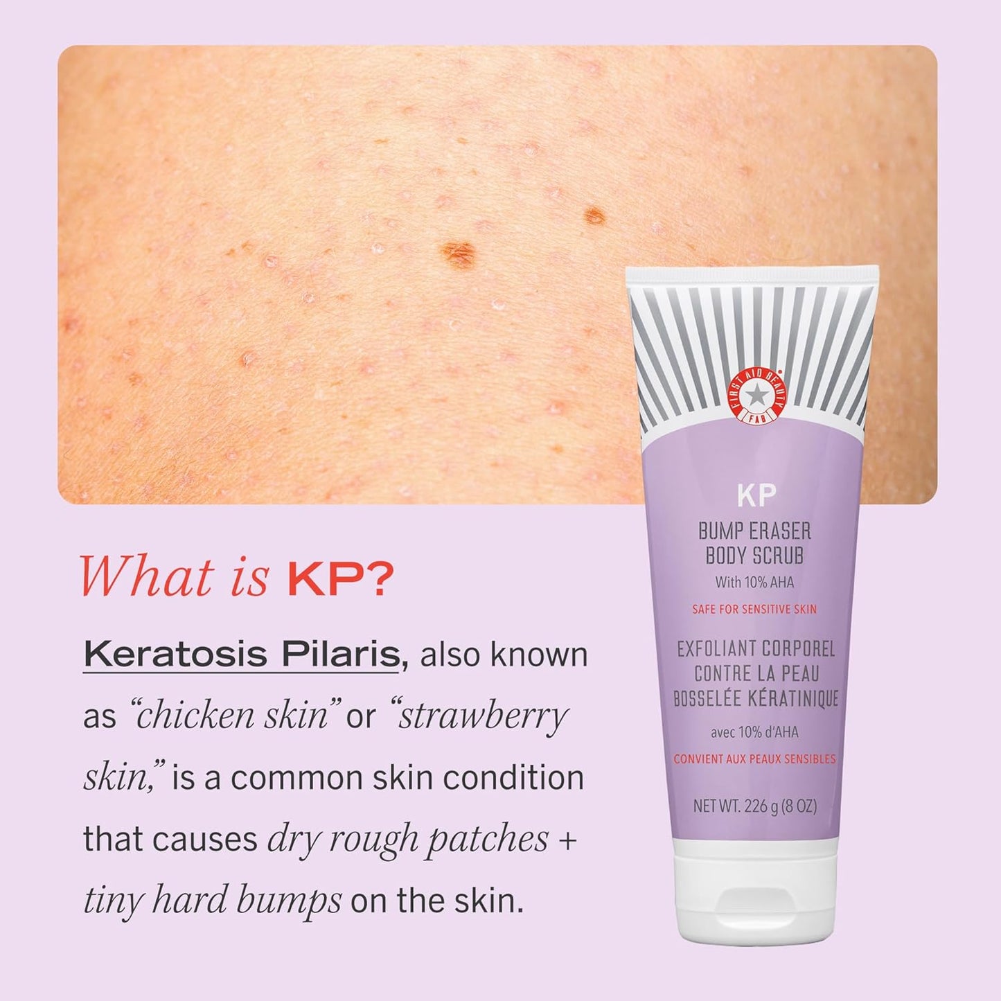 First Aid Beauty KP Bump Eraser Body Scrub w. 10% AHA 2oz