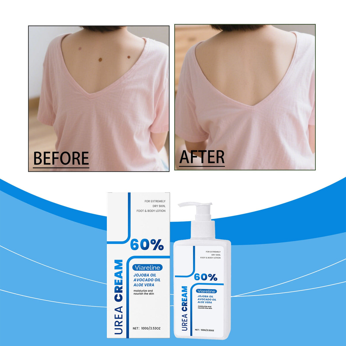 Urea Body Lotion