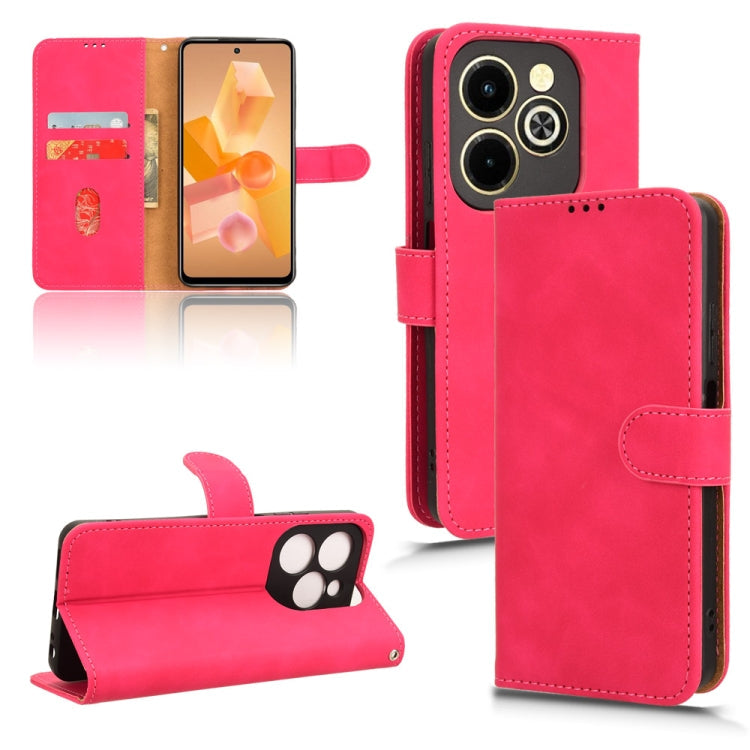 Skin Feel Magnetic Flip Leather Phone Case, For Infinix Note 40 5G, For Infinix Hot 40i, For Infinix Smart 8, For Infinix Zero 30 5G