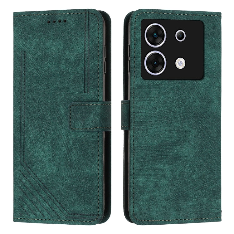 Skin Feel Stripe Pattern Leather Phone Case with Lanyard, For Infinix Zero 30 4G, For Infinix Zero 30 5G, For Infinix Hot 30 Play NFC, For Infinix Note 30/Note 30 5G