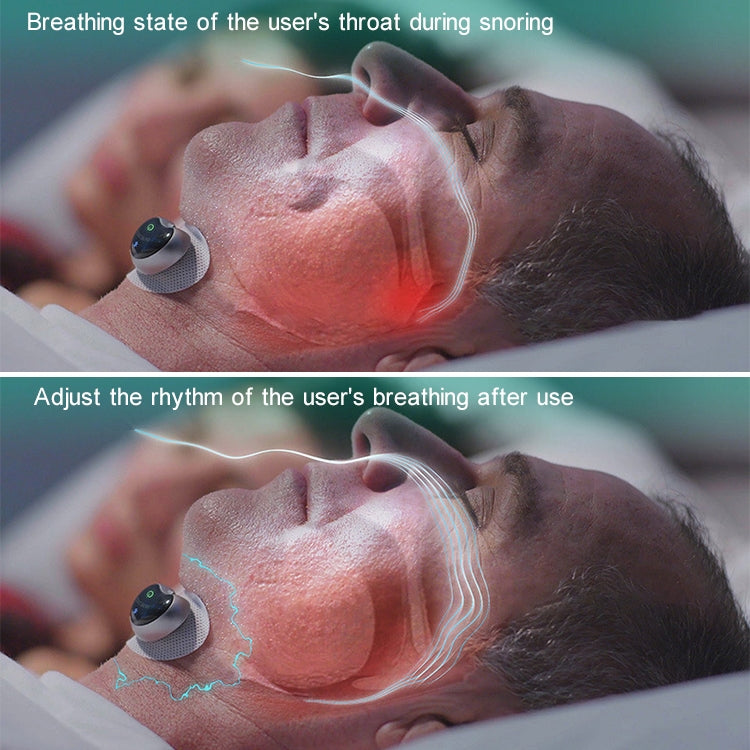 Adult Home Smart Throat Anti-snoring Device Sleep Stickers, YA4200