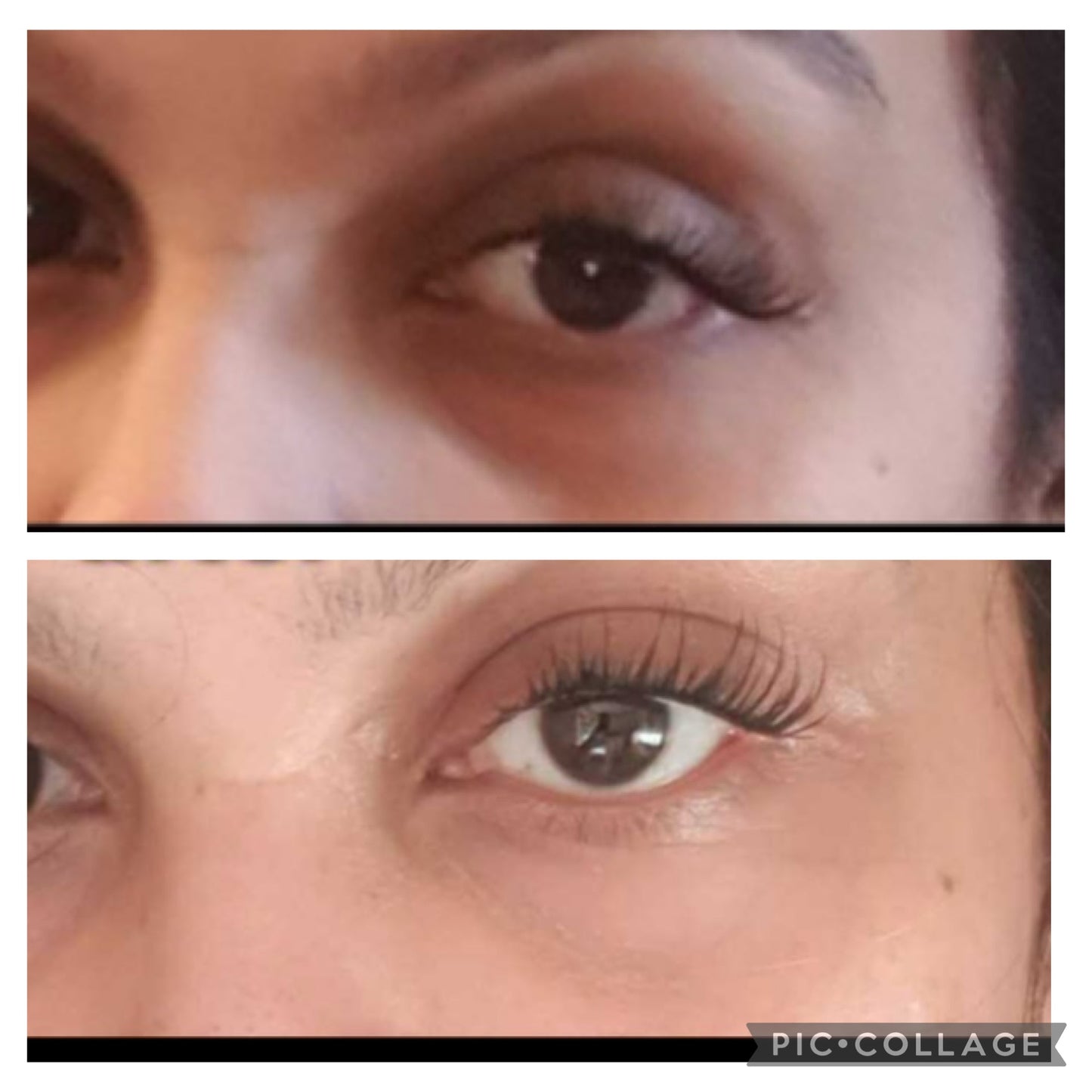 Dark Circles Under Eye Oil