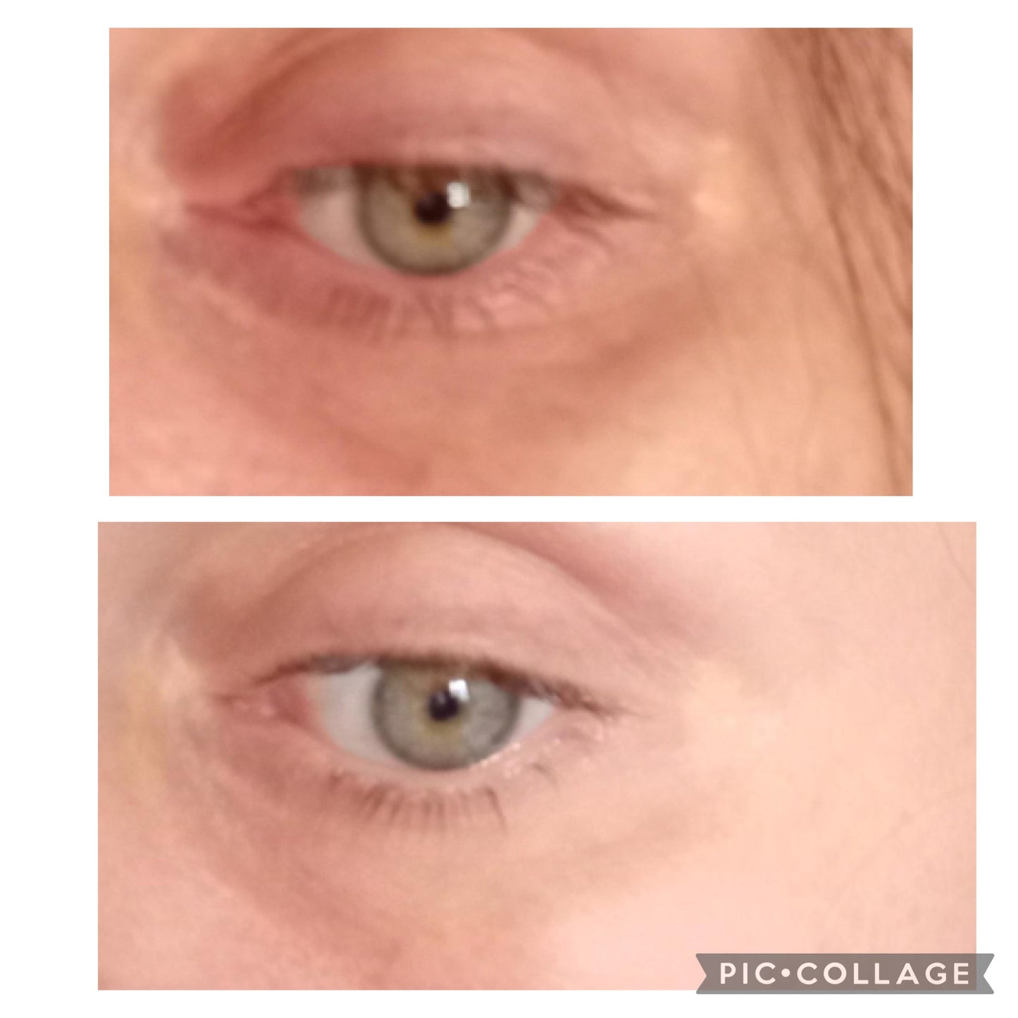 Dark Circles Under Eye Oil