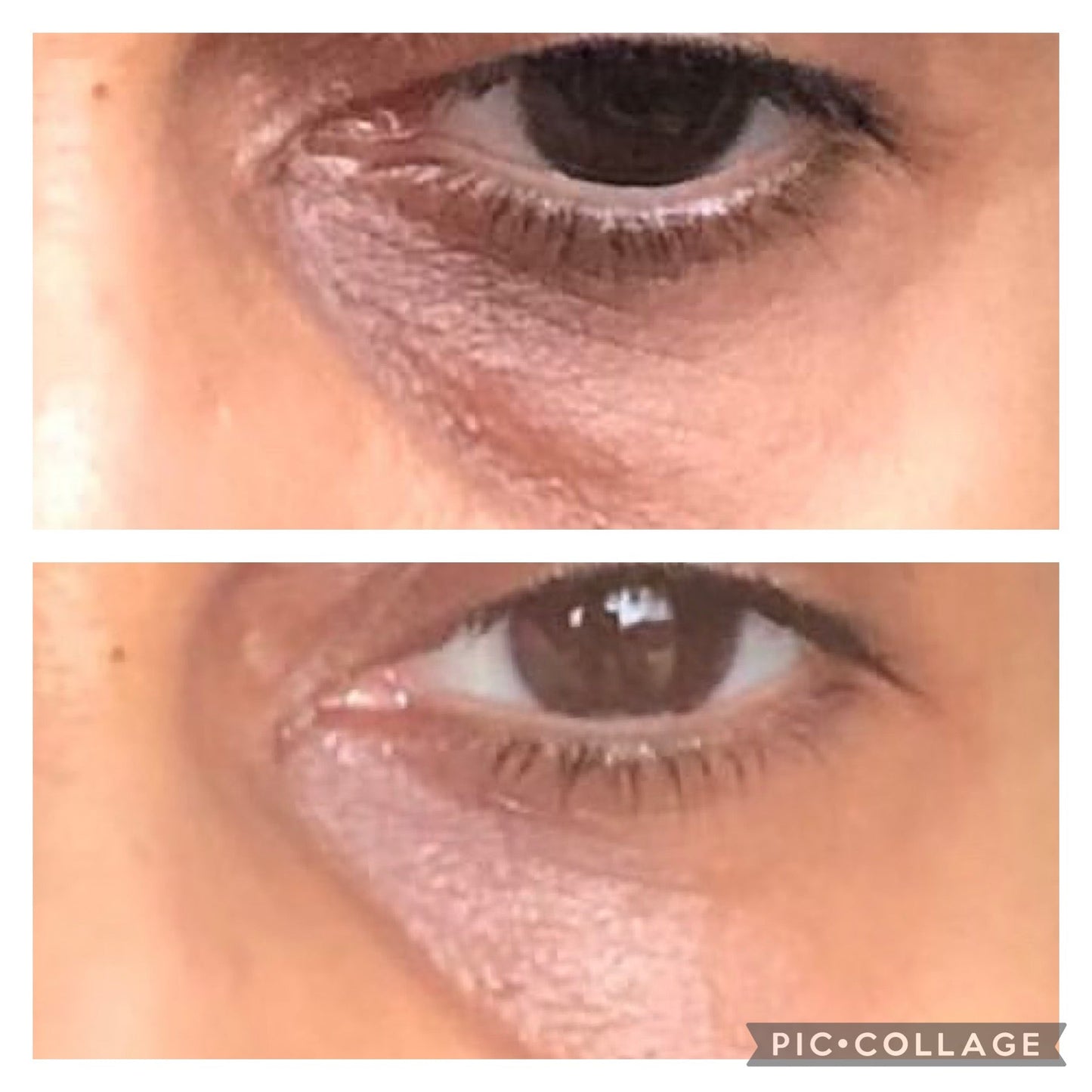 Dark Circles Under Eye Oil