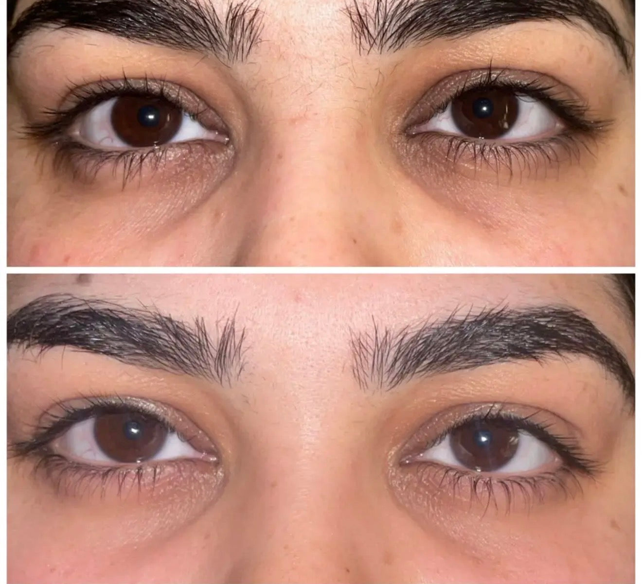 Dark Circles Under Eye Oil