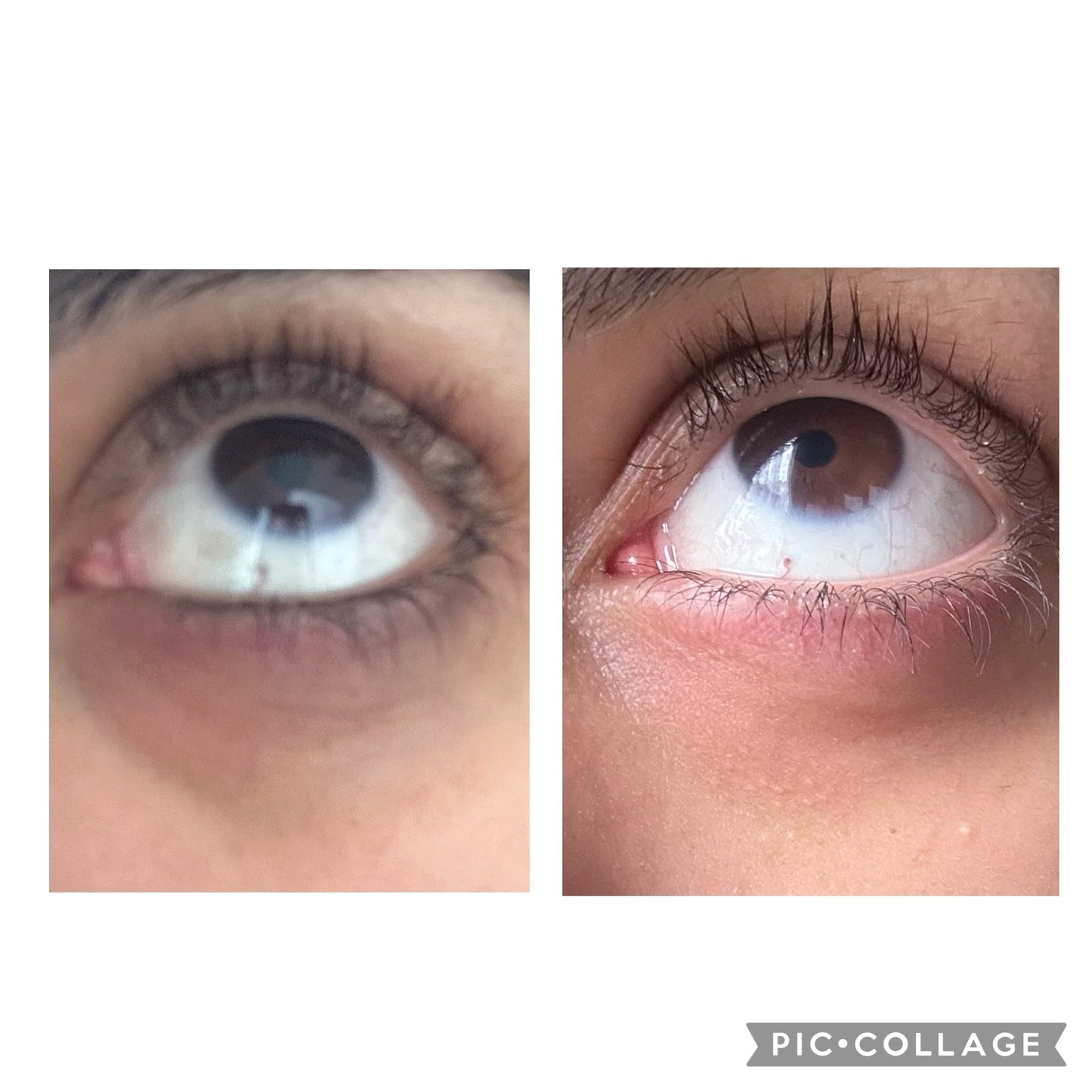 Dark Circles Under Eye Oil