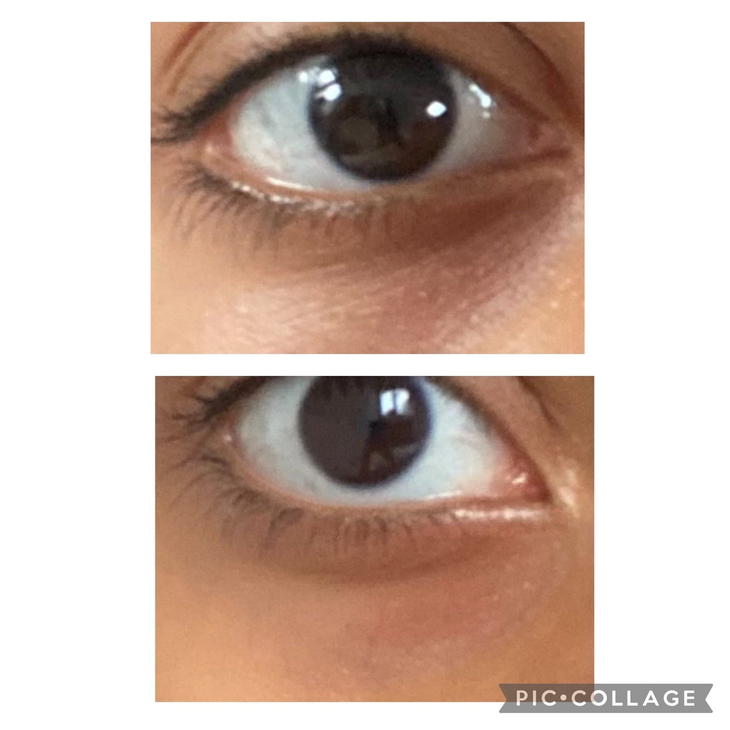 Dark Circles Under Eye Oil