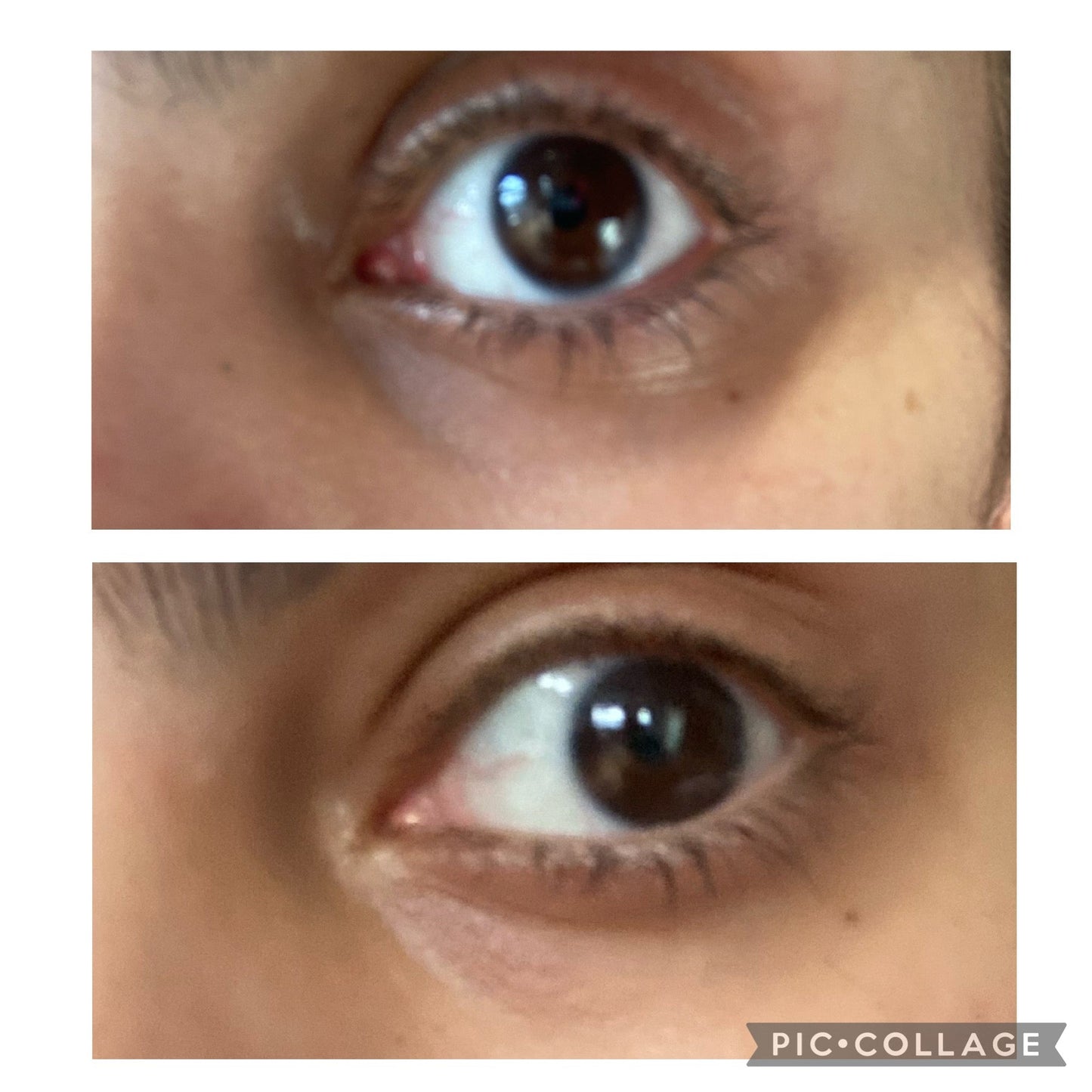 Dark Circles Under Eye Oil