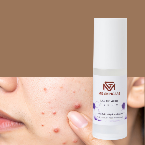 LACTIC ACID SERUM
