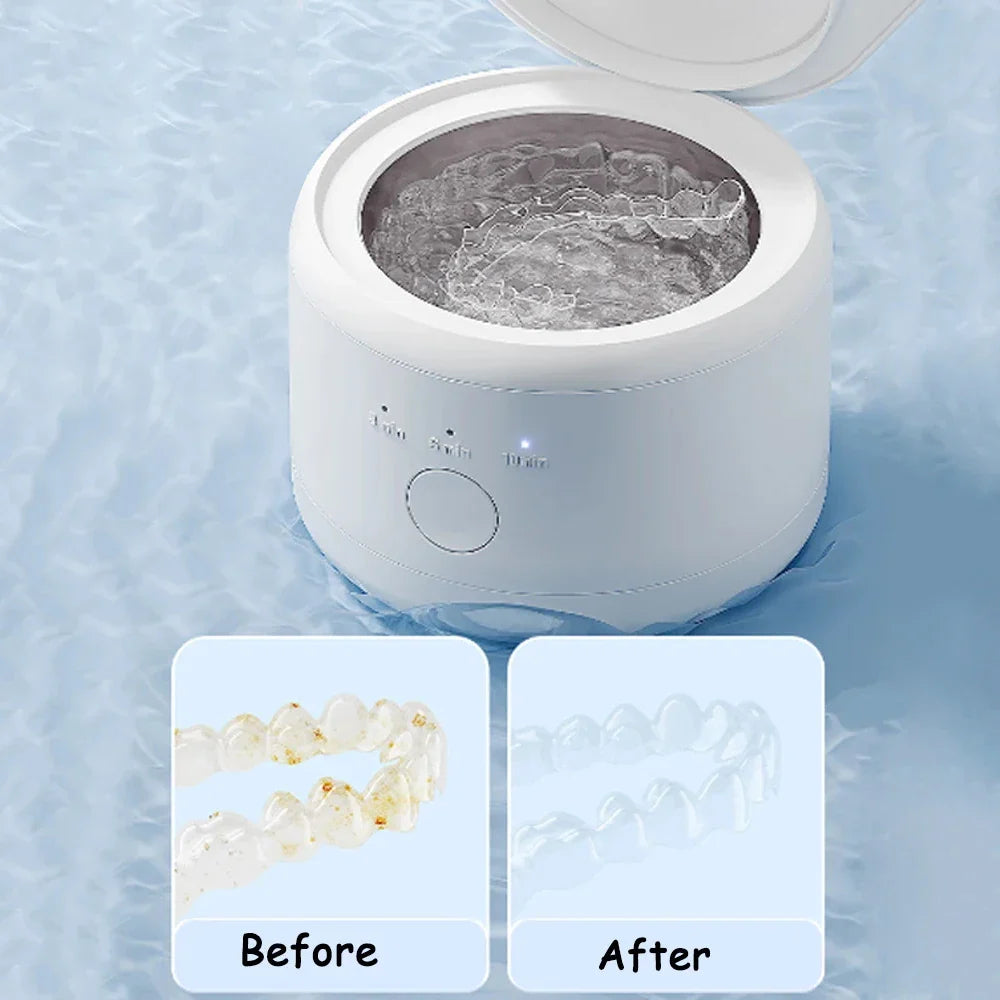 15W Ultrasonic Cleaner for Dentures Professional Ultrasonic Cleaning Machine for All Dental Jewelry Watch Household Washer 160ml
