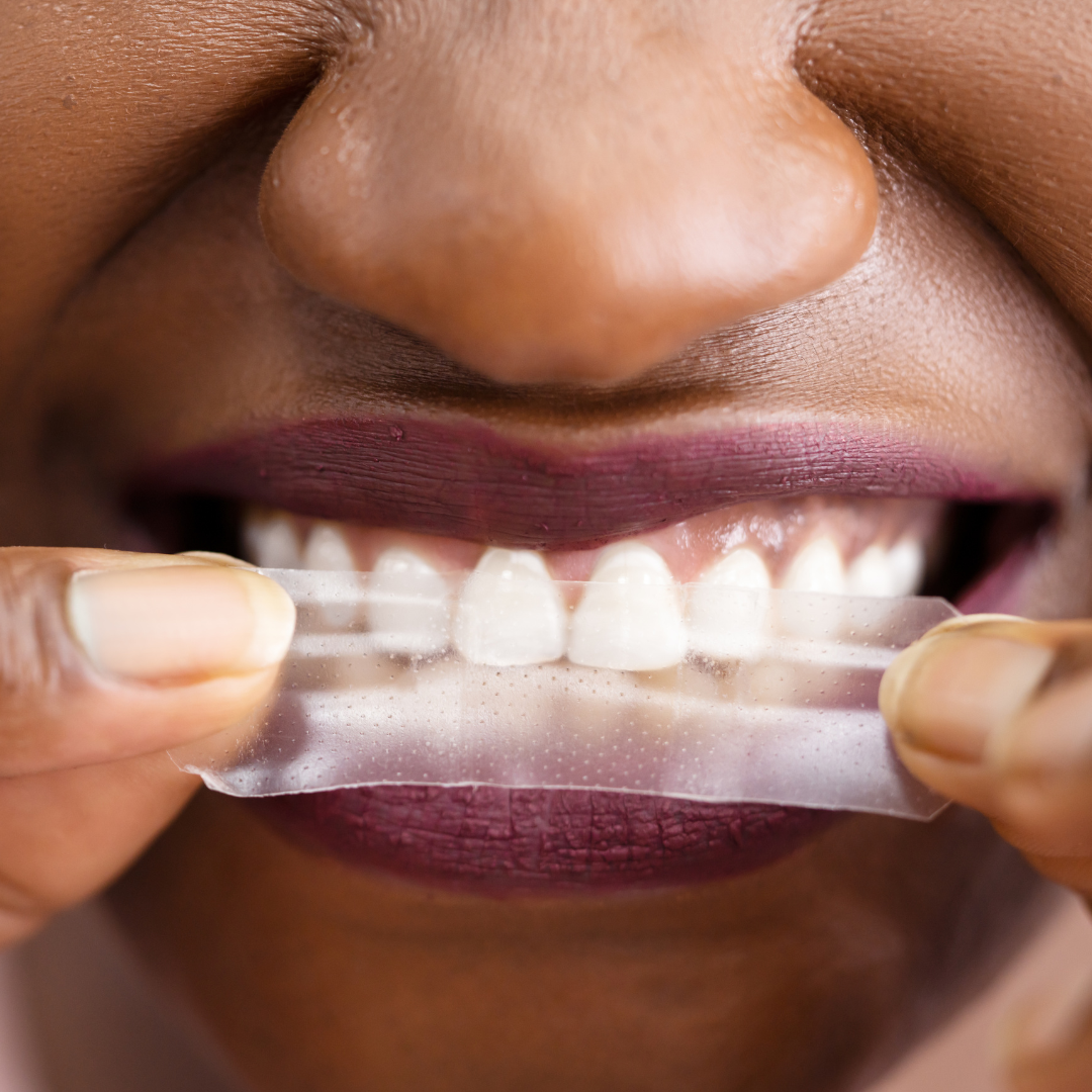 All Rounder Whitening Set - PAP-X™ Advanced Teeth Whitening Strips & Pen