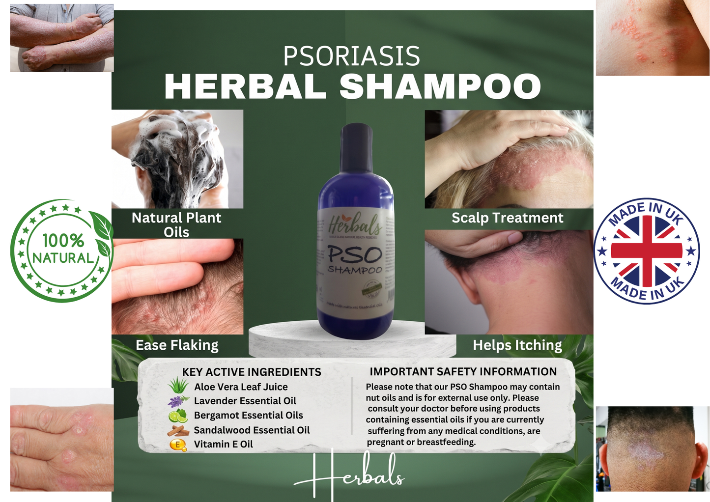Psoriasis Shampoo For Scalp Itchy 250ml Soothe Itching Burning Flaky Naturally