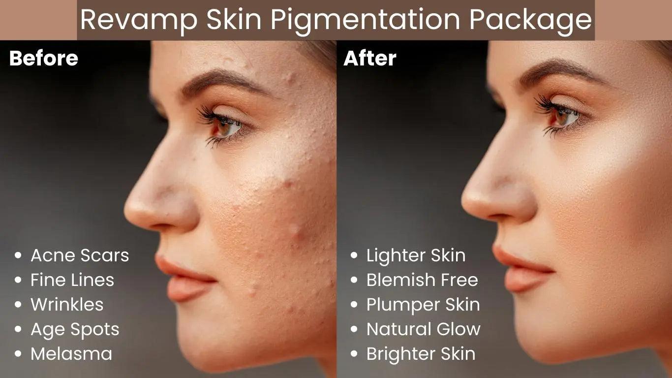 Ammuri Pigmentation Skincare Gift Set - Brightening Dark Spot Treatment Bundle