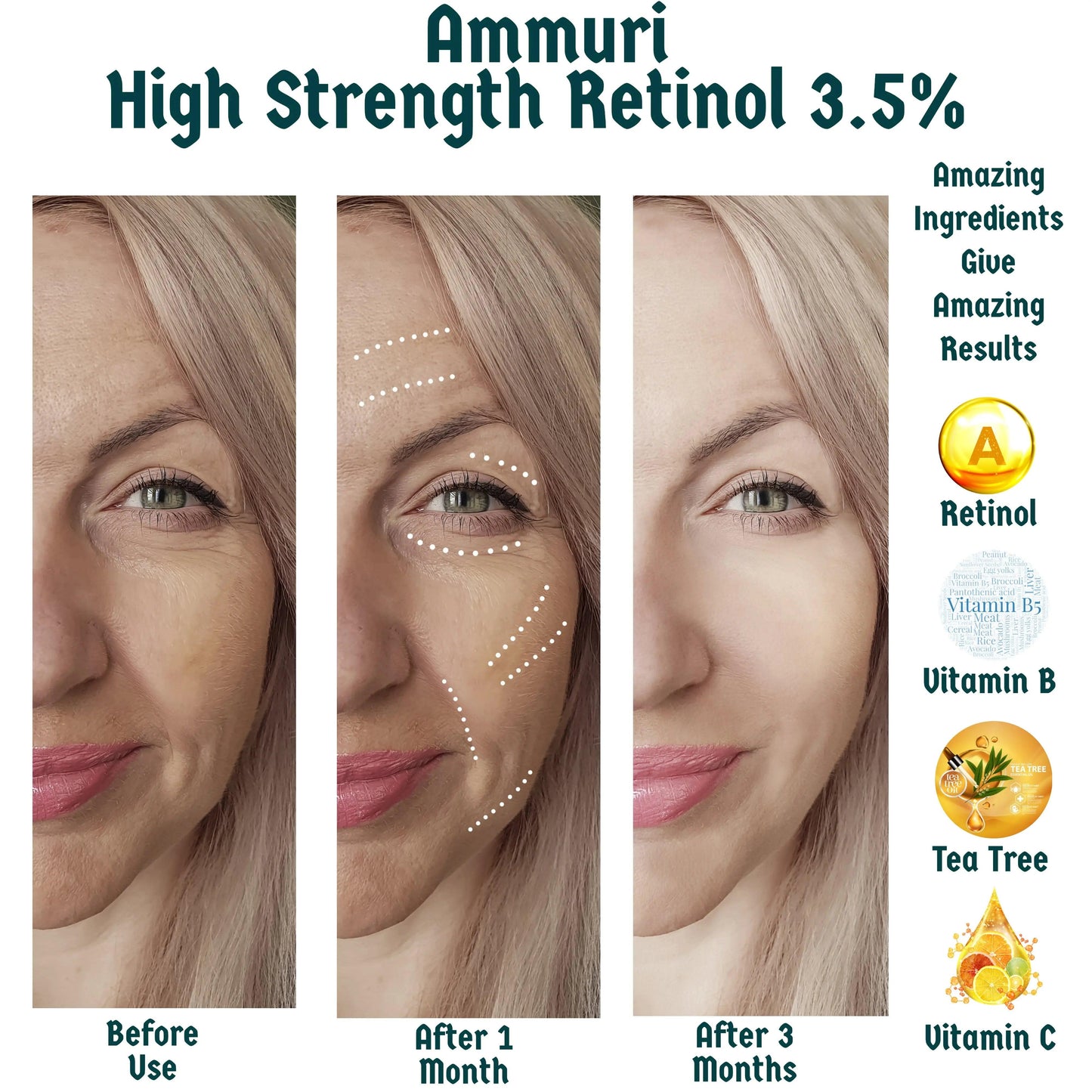 3.5% Retinol Serum for Wrinkles & Skin Renewal | Ammuri