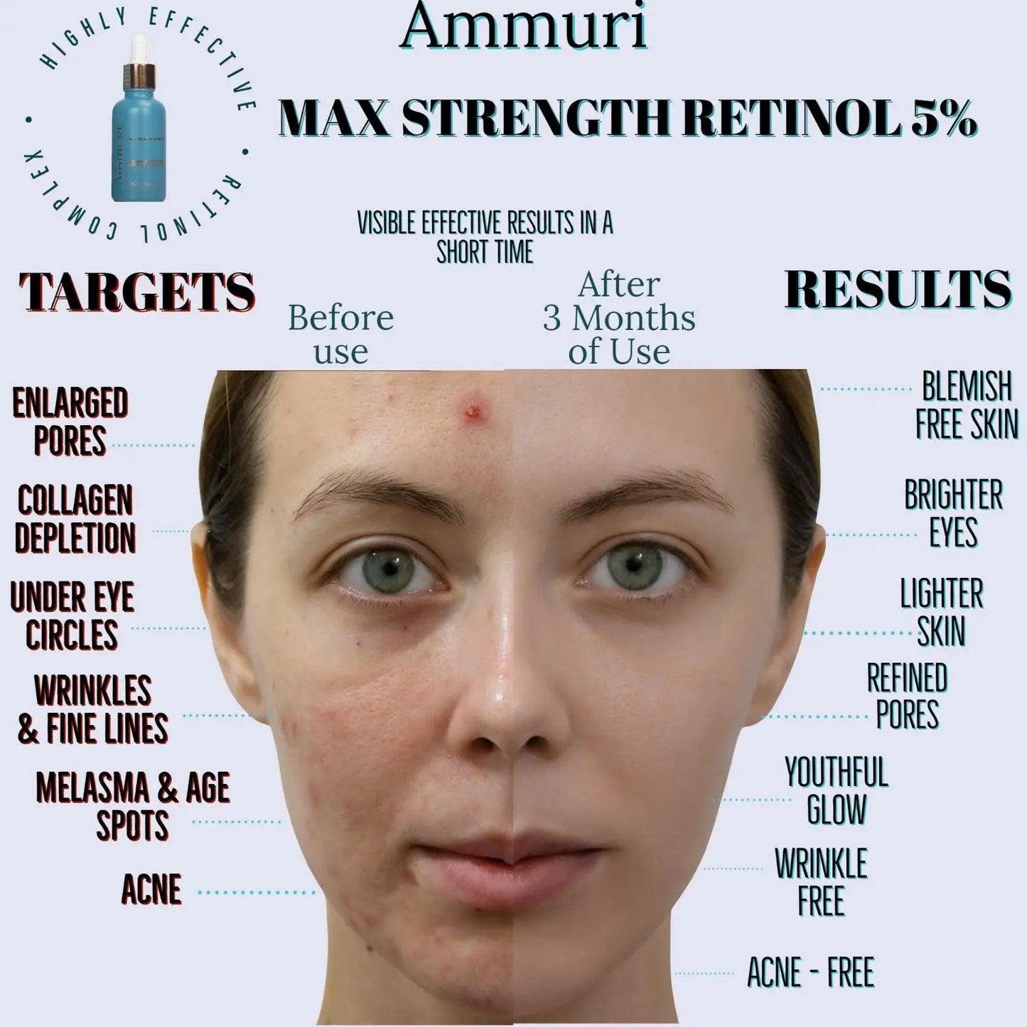 Ammuri Retinol 5% Serum – Step-Up Anti-Ageing Formula for Experienced Users | 30ml