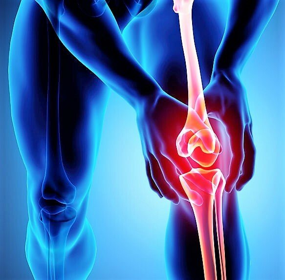 Arthritis Pain Relief Cream Joint Knee Hip Osteoarthritis Ointment Fast Acting