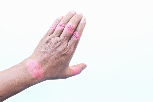 Arthritis & Rheumatism Ointment Reduce Inflammation Enhance Mobility Handmade