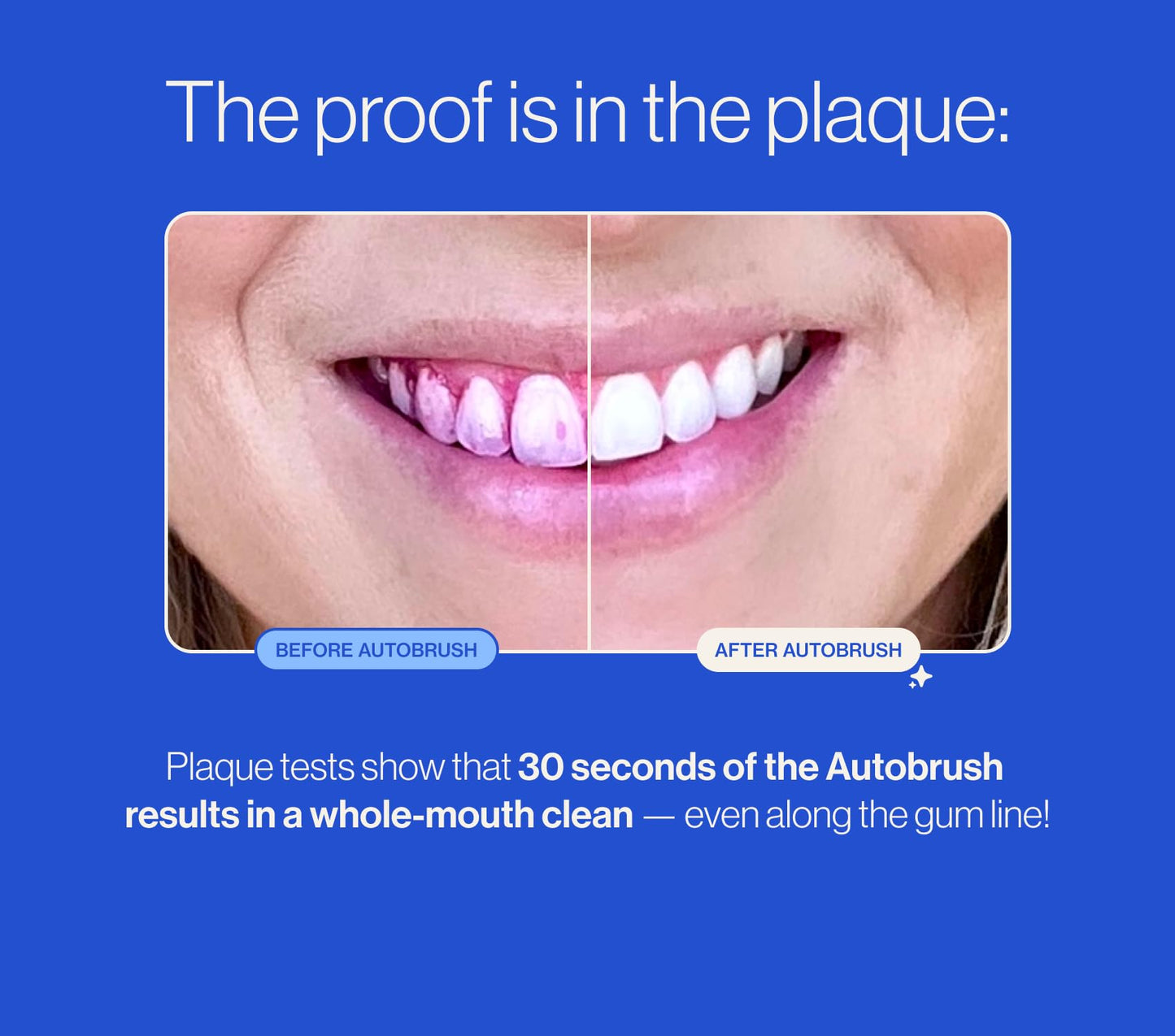 autobrush Kids Electric Toothbrush – ADA-Accepted U-Shaped, 5.1x Plaque Removal, 30s 360° Cleaning, Ages 9-12, Dinosaur