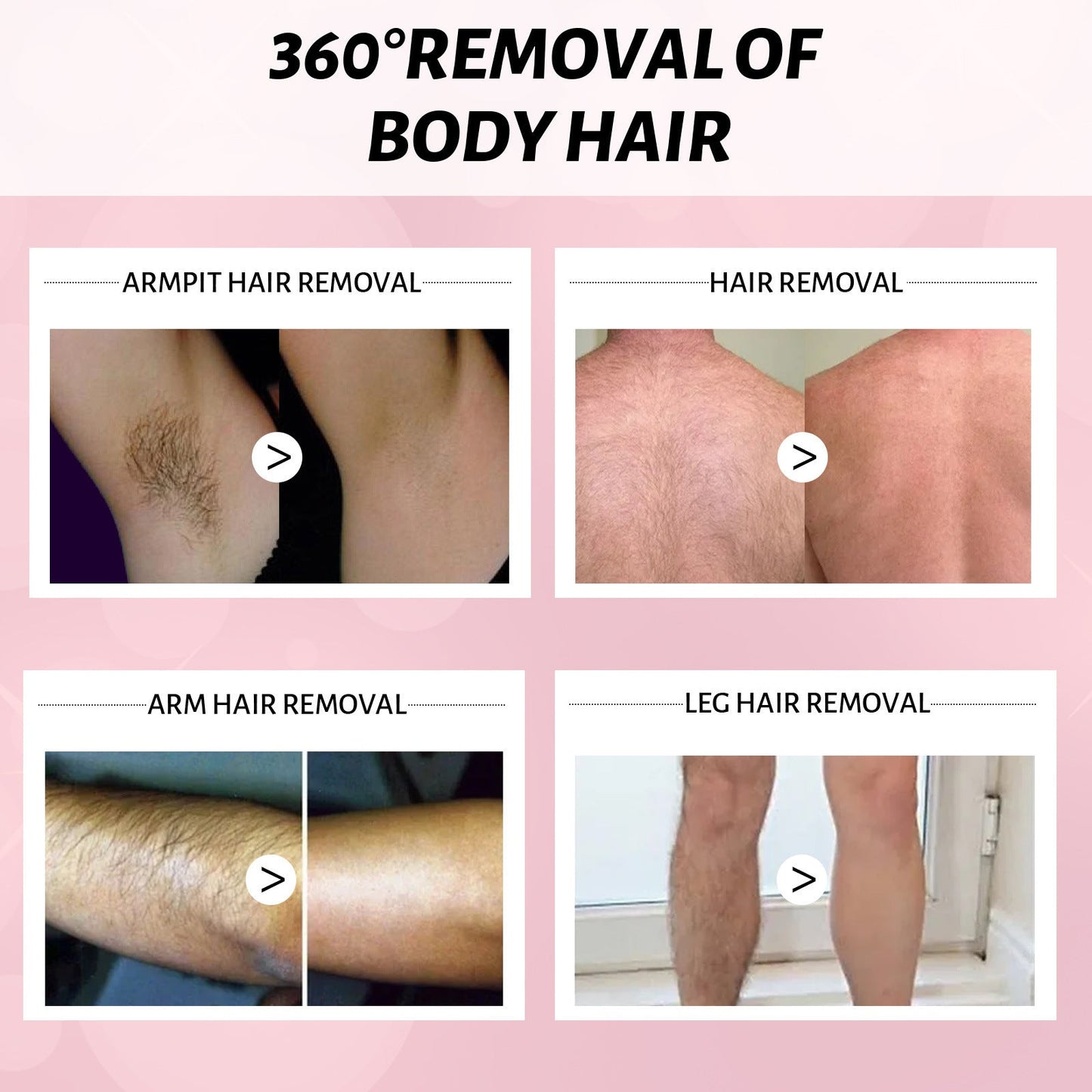 30ml 100ml Hair Removal Spray Depilatory Armpit Hair And Legs Hair Foam Mousse And Removal Is Gentle Hair Cream Spray Non-irritating