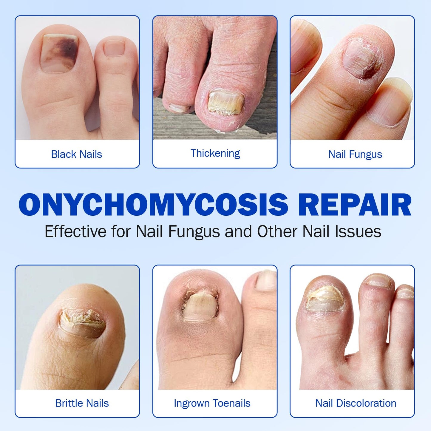 Cacukn Toenail Treatment Extra Strength – 2 Pack Nail Repair Patches (42 Pcs) | Overnight Renewal