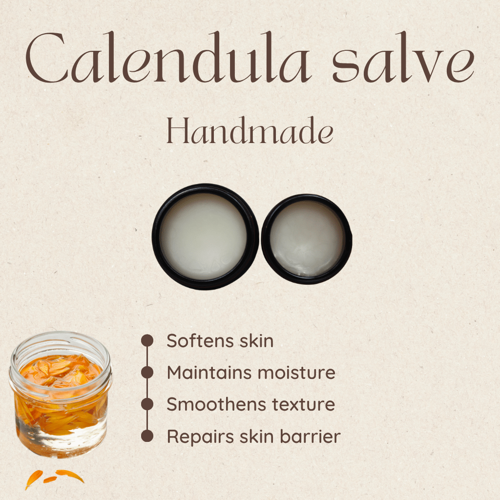 Calendula Cream Ointment Natural Skin Healing Cuts Burns Acne Stretch Marks