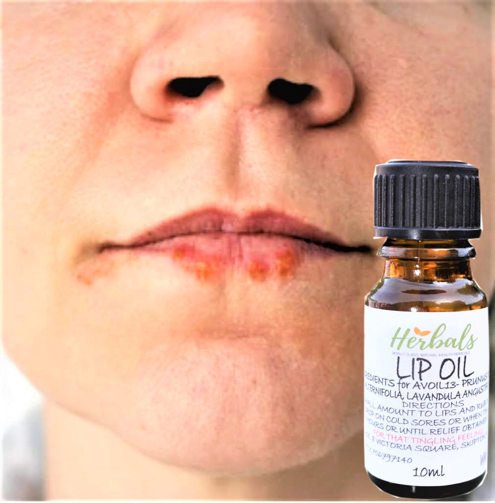 Herbal Lip Oil: The Best Cold Sore Treatment Alternative