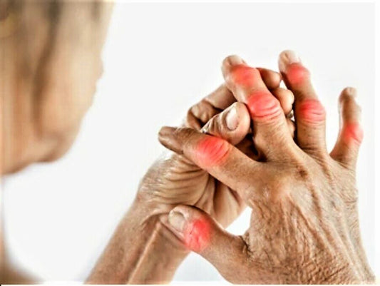 Gout Pain Relief Cream Natural Herbal Gouty Arthritis Soothing Balm Ease Pain