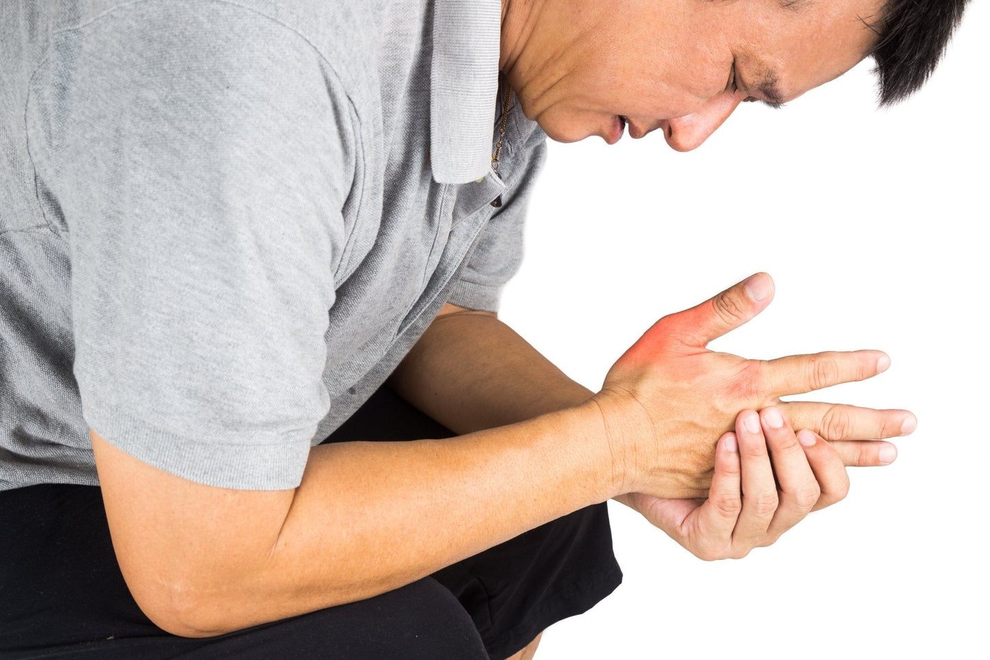 Gout Treatment Herbal Cream - Natural Pain Relief for Gout Arthritis - Handmade