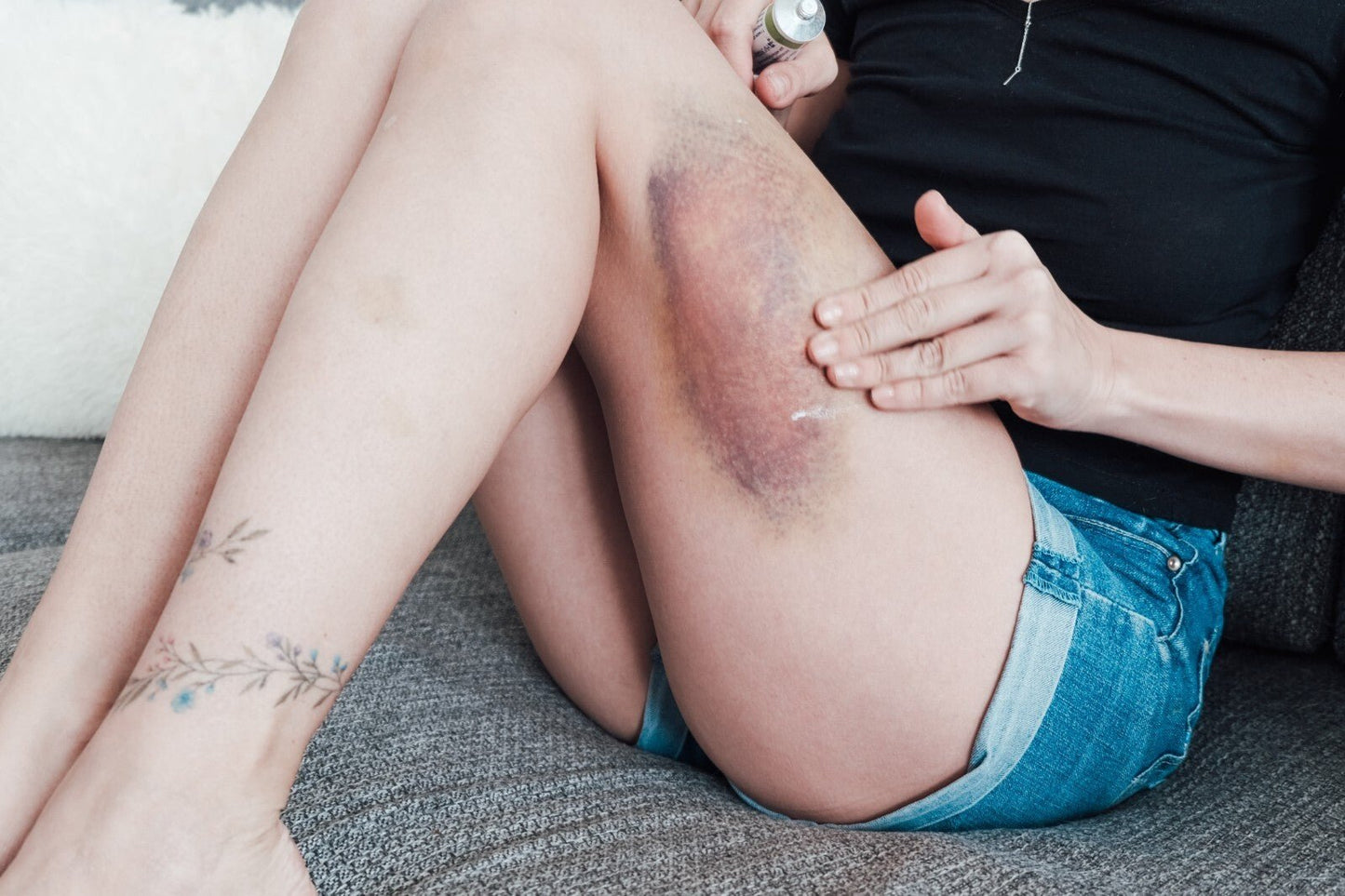 Handmade Arnica Balm Muscle Rub | Natural Pain Relief for Bruises & Sore Muscles