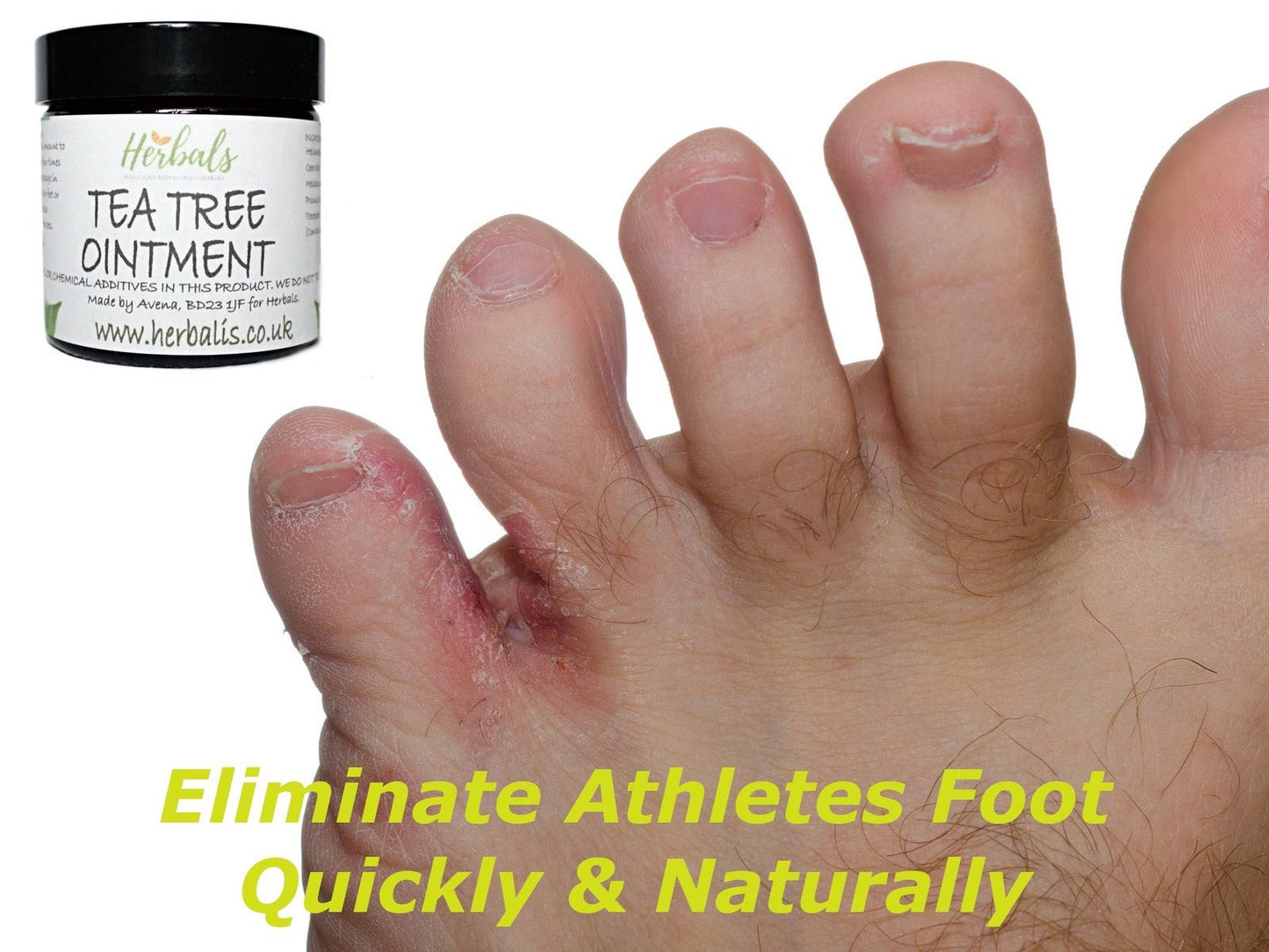 Herbalshire Tea Tree Ointment Natural Antifungal Cream - 120ml - Handmade Skinc