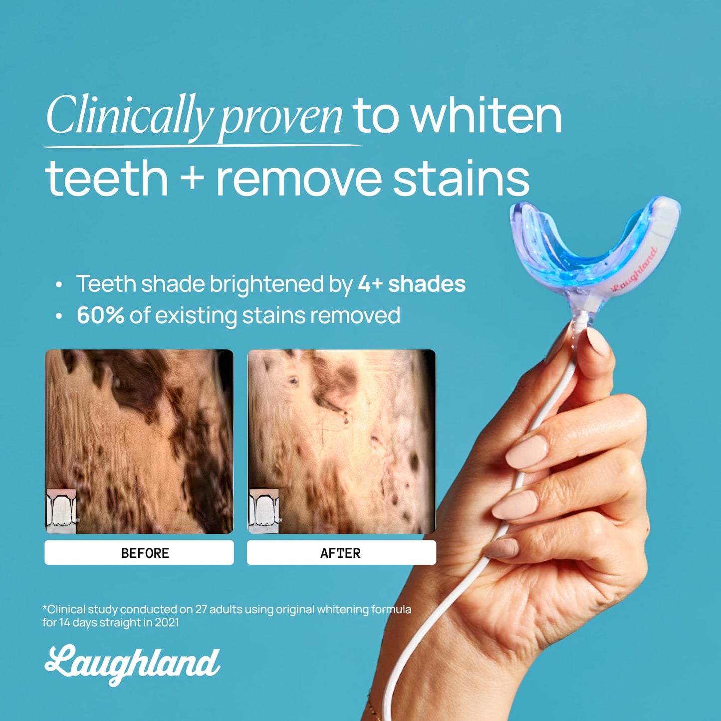 Laughland Gentle Teeth Whitening Kit - Phone-Powered LED Mouthpiece and 6+ Treatments