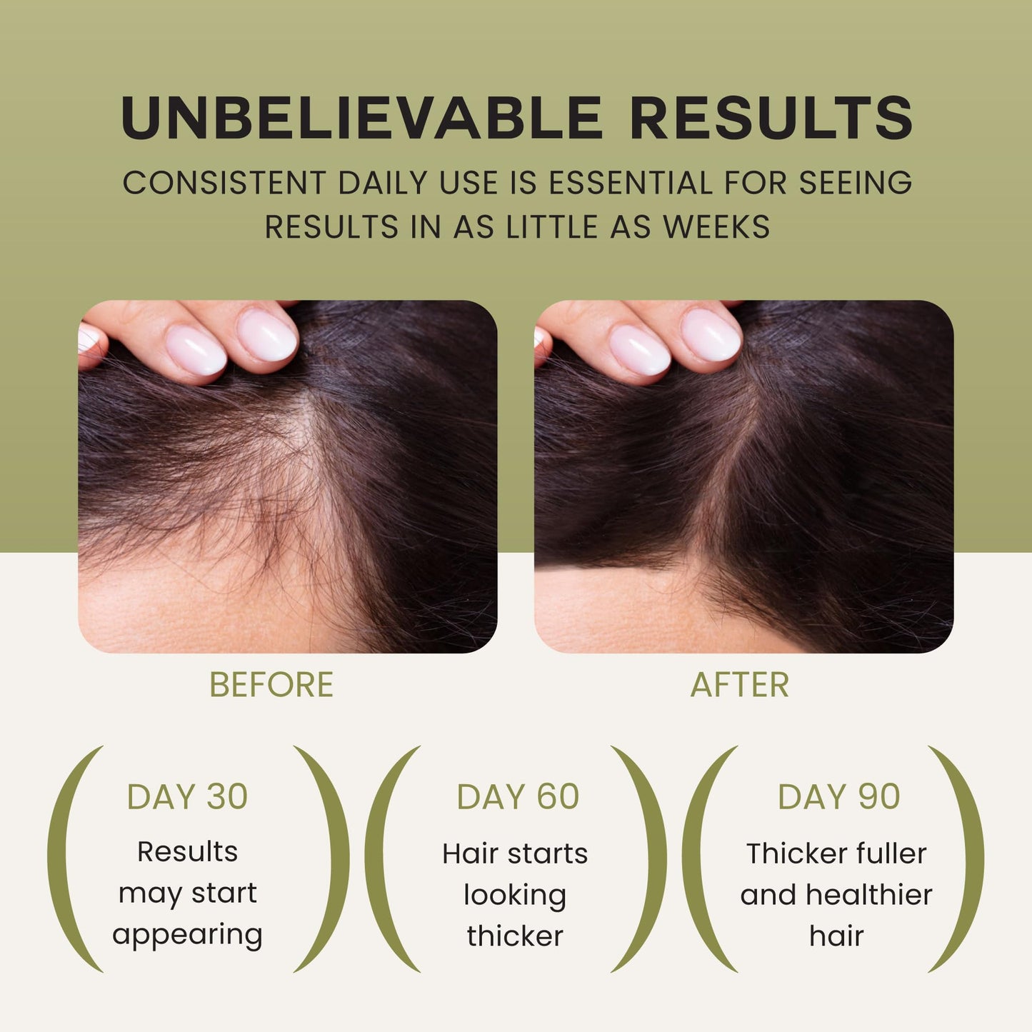 Lebanta Batana Oil for Hair Growth – 100% Pure, Organic Blend with Castor, Pumpkin Seed, Coconut & Rosemary (1 Pack)