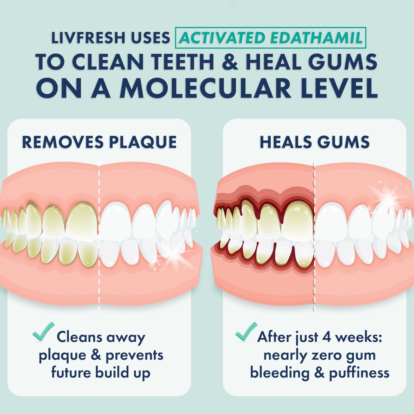 LIVFRESH Toothpaste Gel – Clinically Proven Plaque Removal, Gum Health, Wintergreen
