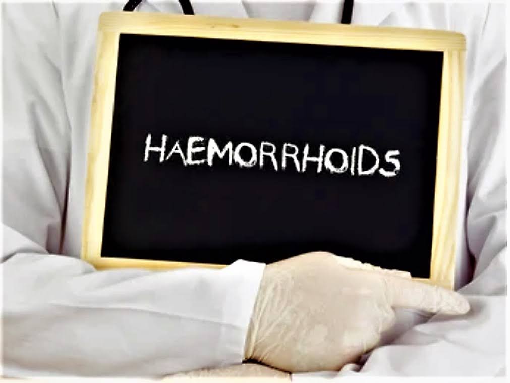 Natural Ointment Piles Haemorrhoids Soothing Cooling Swelling Haemorrhoid Relie