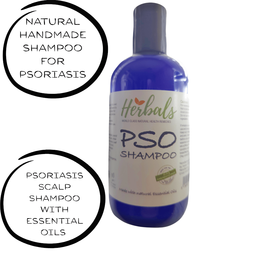 Natural Psoriasis Shampoo – Handmade Relief for Dry, Flaky, Itchy Scalp – 250ml