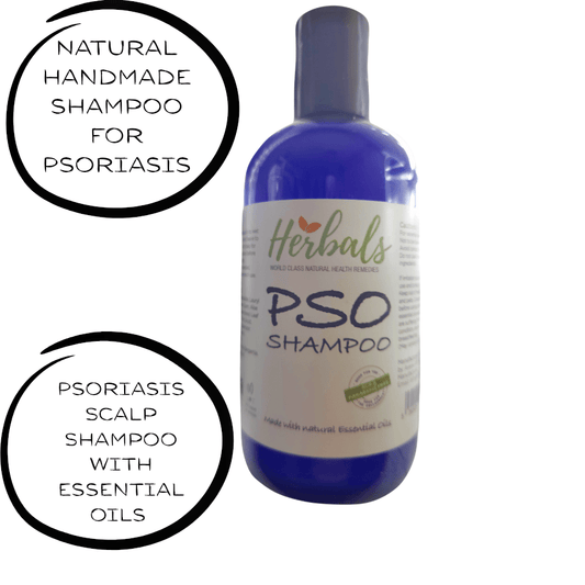 Natural Psoriasis Shampoo – Handmade Relief for Dry, Flaky, Itchy Scalp – 250ml