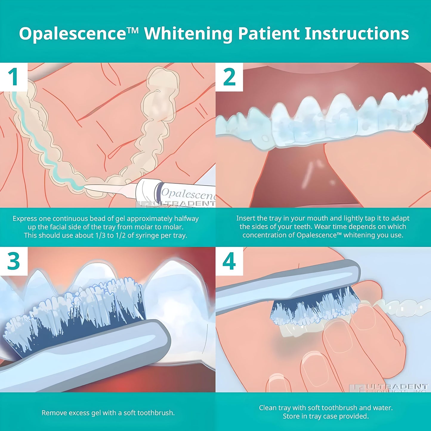 Opalescence 15% Gel Syringes Whitening Refill Kit – Low Sensitivity, 8 Syringes | Made in USA by Ultradent (5195-4)