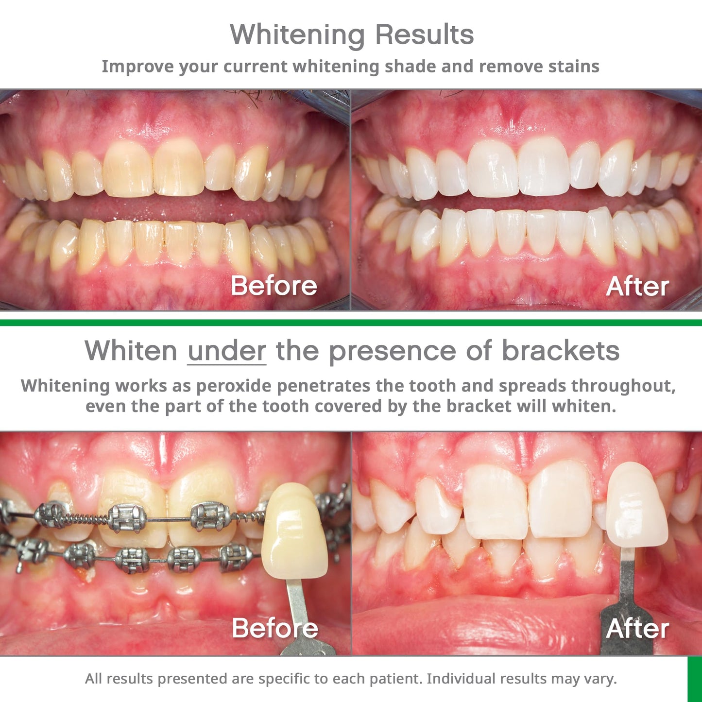Opalescence Whitening Bundle: Go 15% Trays + Mint Toothpaste (5194-5166)