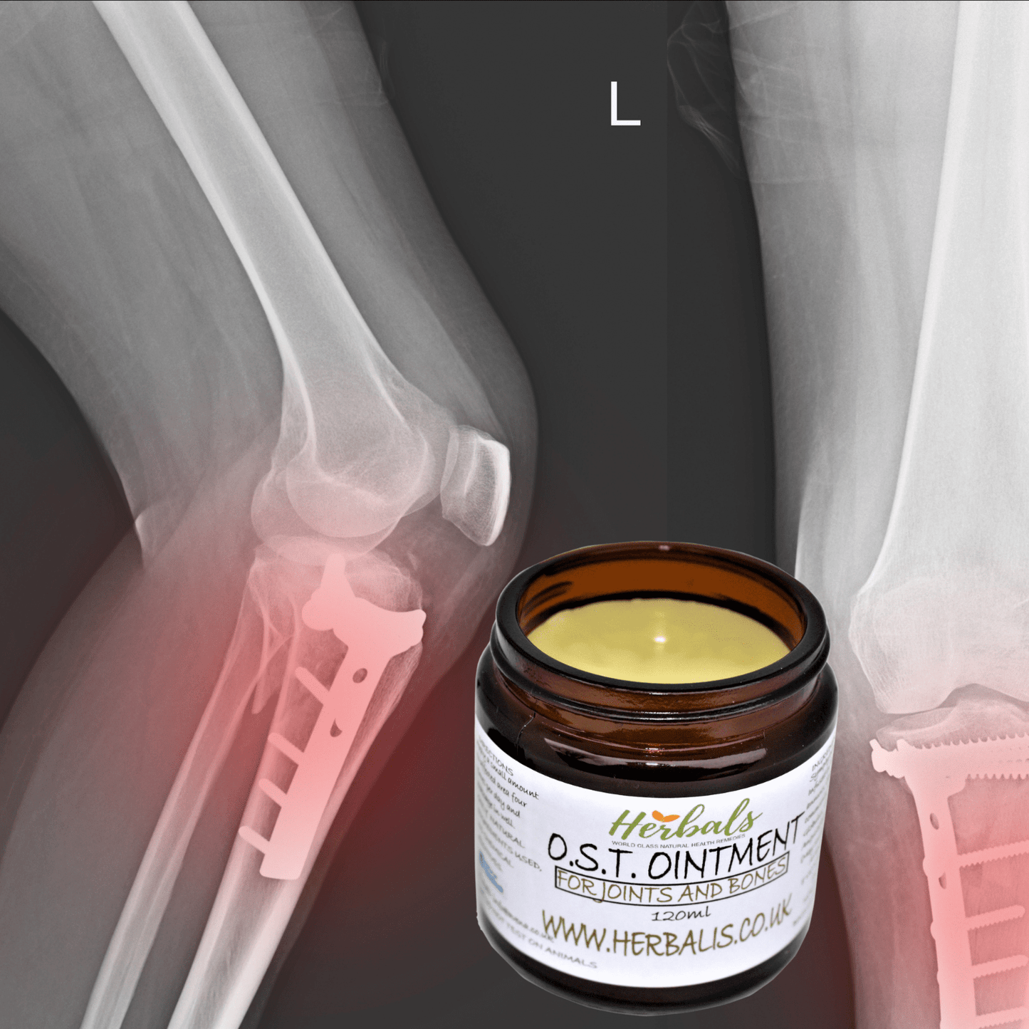 Osteoarthritis Cream Joint Knee Hip Fingers Pain Relief Fibromyalgia Flare Up
