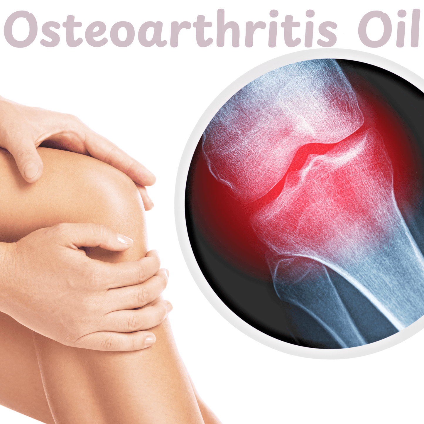 Osteoarthritis Knee Joint Pain Relief Oil – Natural O.S.T. Massage Blend