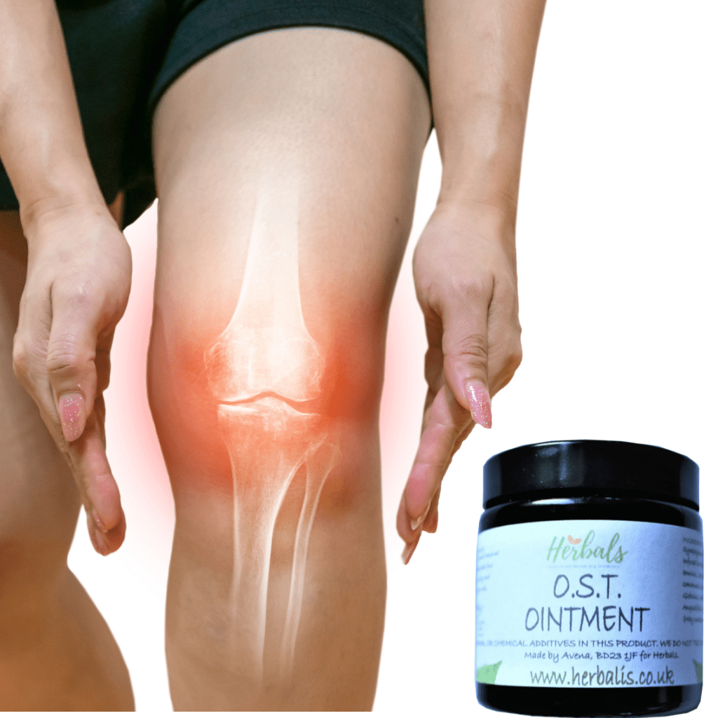 Osteoarthritis Pain Relief Cream | Natural Joint Balm for Knee, Hip, Spine & Hands | UK Handmade