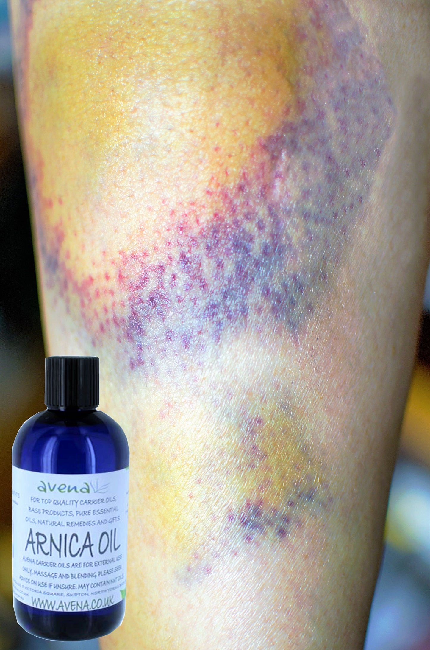 Arnica Massage Balm – Natural Skin Care & Relaxing Body Cream & Oil – Handmade in Yorkshire