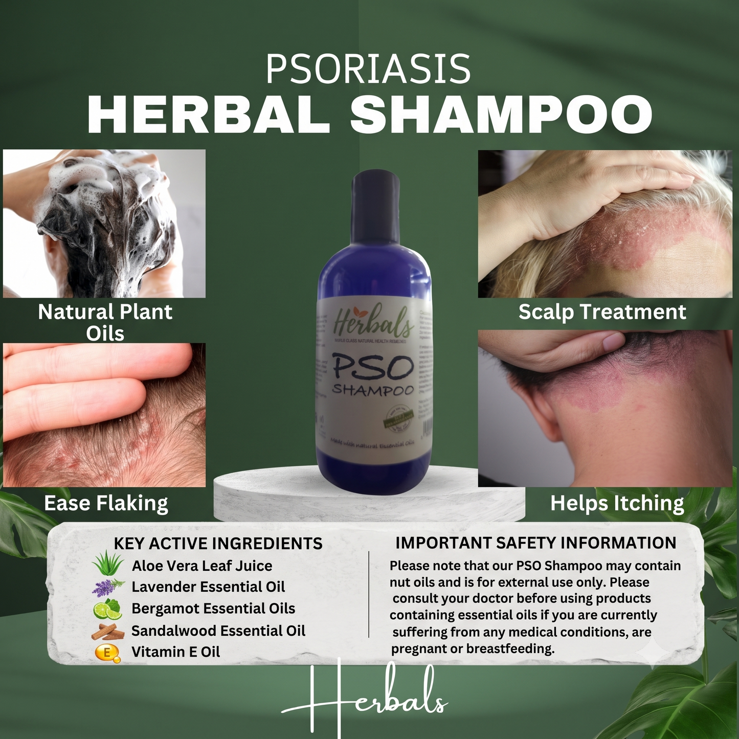Herbalshire Scalp Psoriasis Shampoo - Natural Herbal Relief for Inflamed Scalp