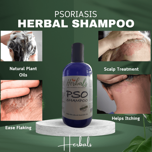 PSO Herbal Scalp Care Shampoo - Effective Dandruff Treatment & Soothing Psoriasis Relief