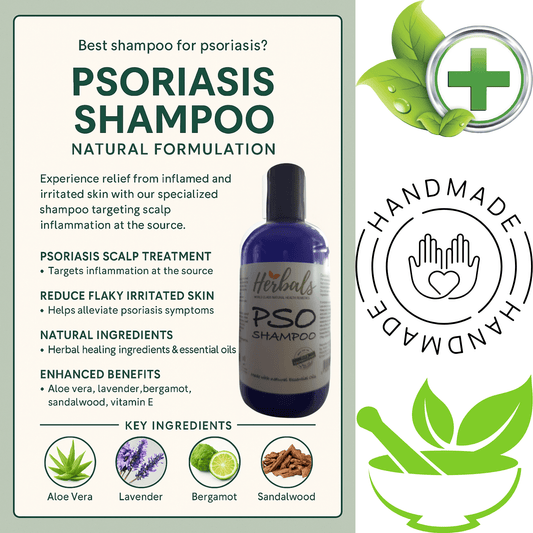 Scalp Psoriasis Treatment Shampoo Natural Handmade Relief for Flaky Itchy Scalp